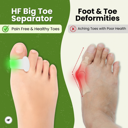 HF Big Toe Separator – For Daily Comfort & Gentle Toe Separation